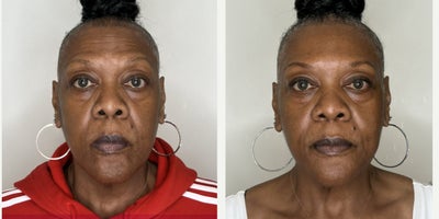before and after image