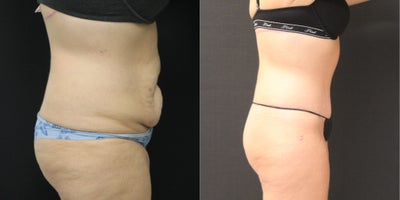 before and after image