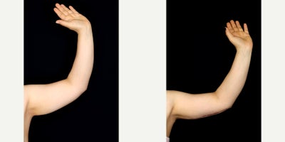 before and after image
