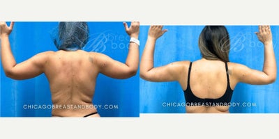 before and after image