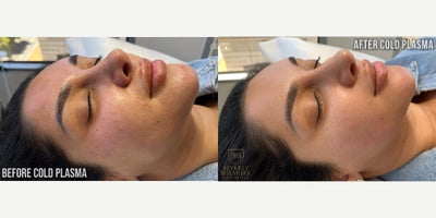 before and after image