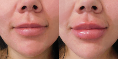 before and after image