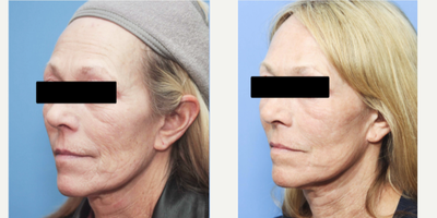 before and after image