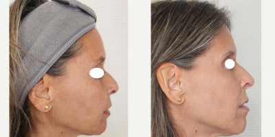 before and after image