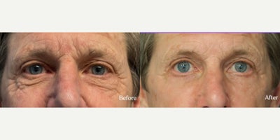 before and after image