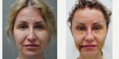before and after image