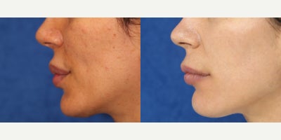 before and after image