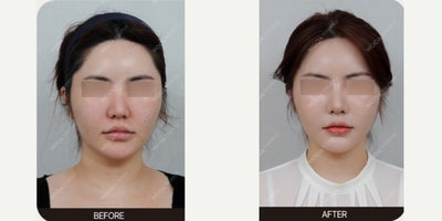 before and after image