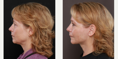 before and after image