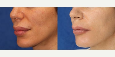 before and after image