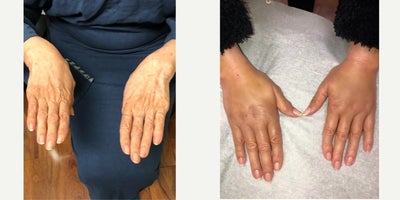 before and after image