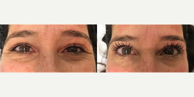 Lash Lift before and after photo