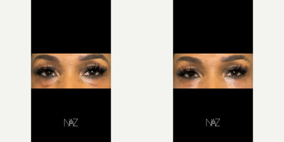 before and after image