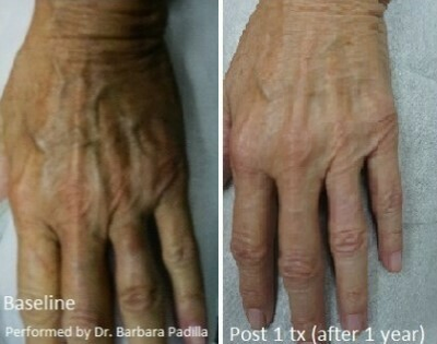 before and after image