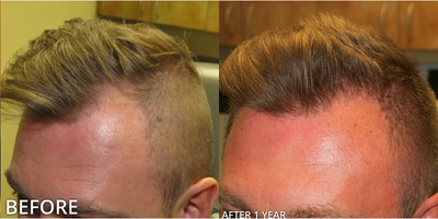 before and after image