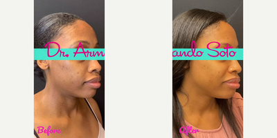 before and after image