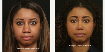 before and after image
