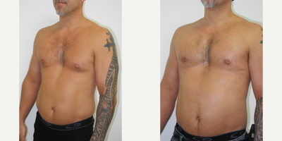 before and after image