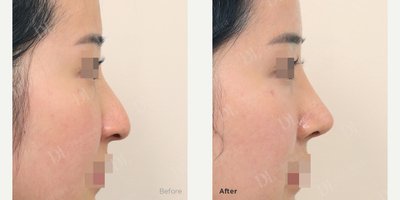 before and after image
