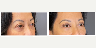 before and after image
