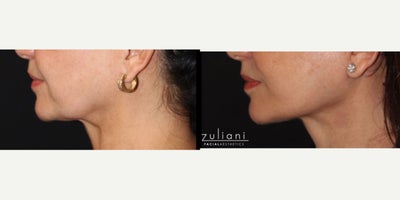 before and after image