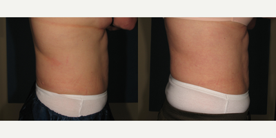 before and after image