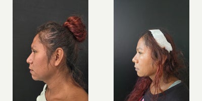 before and after image