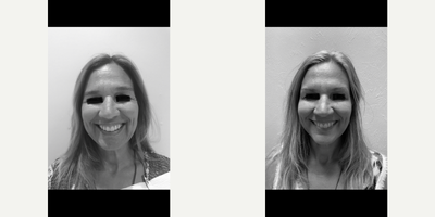 Vivace before and after photo