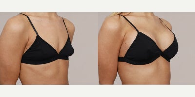 before and after image