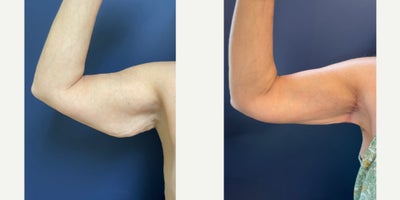 before and after image