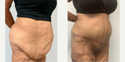before and after image