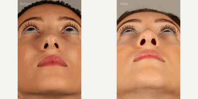 before and after image