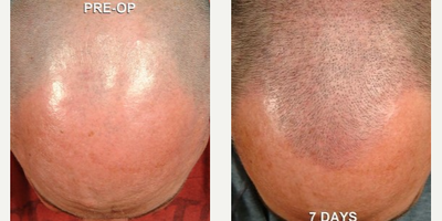 before and after image