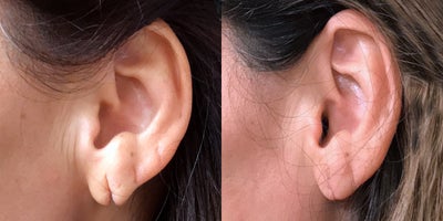 before and after image