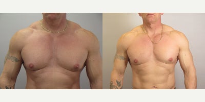 before and after image