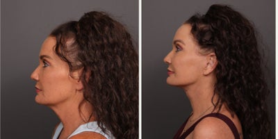 before and after image