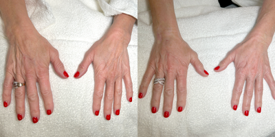 before and after image