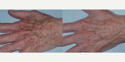 before and after image