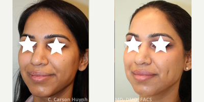 before and after image