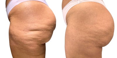 before and after image