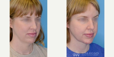 before and after image
