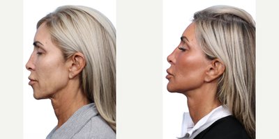 before and after image