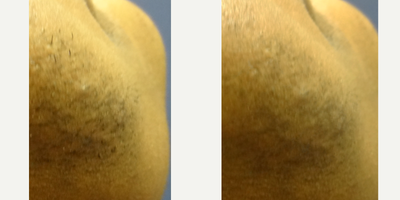 before and after image