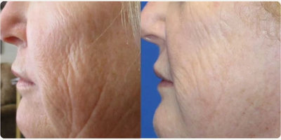 before and after image