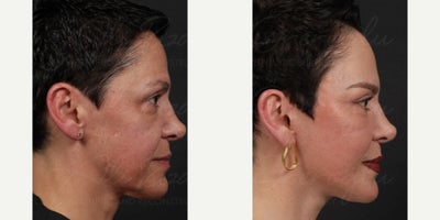 before and after image