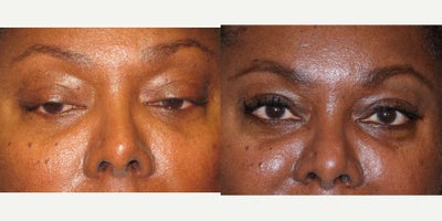 before and after image