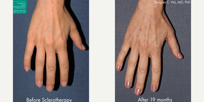 before and after image