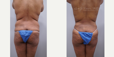 before and after image