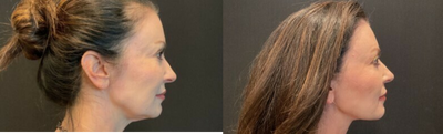 before and after image