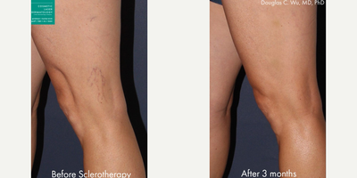 before and after image